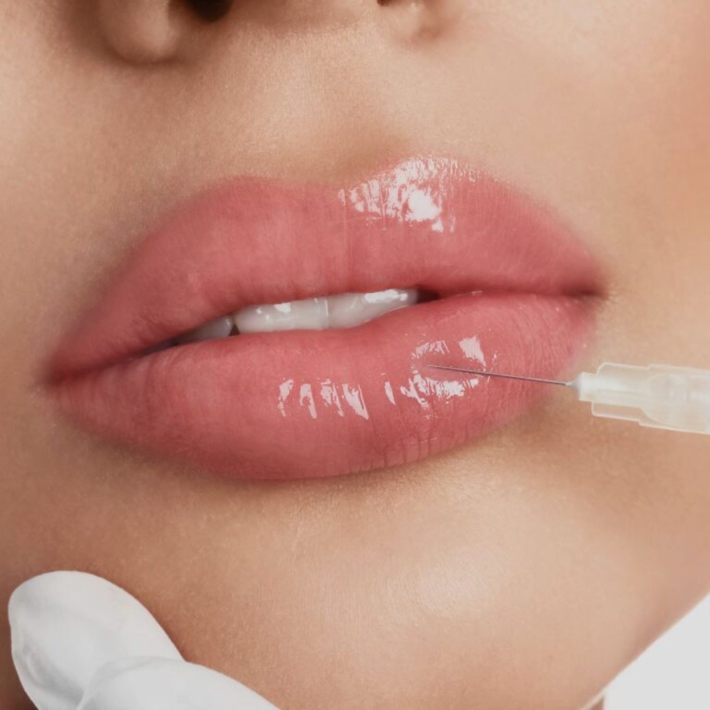 Hyaluron-Behandlungen bei Happy Face Aesthetic