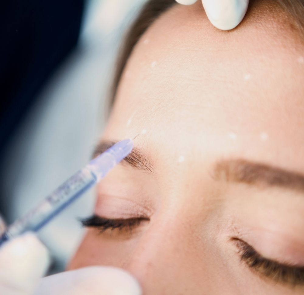 Faltenunterspritzung (Botox)