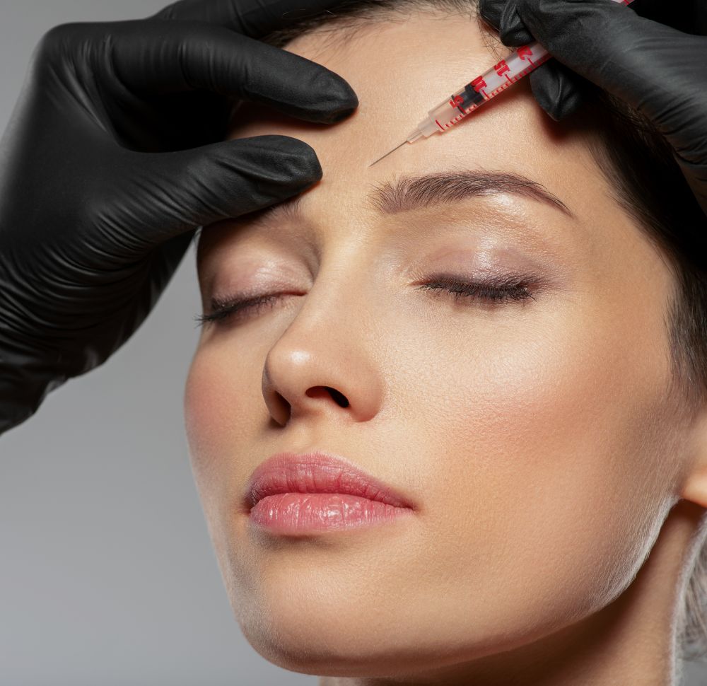 Faltenunterspritzung (Botox)